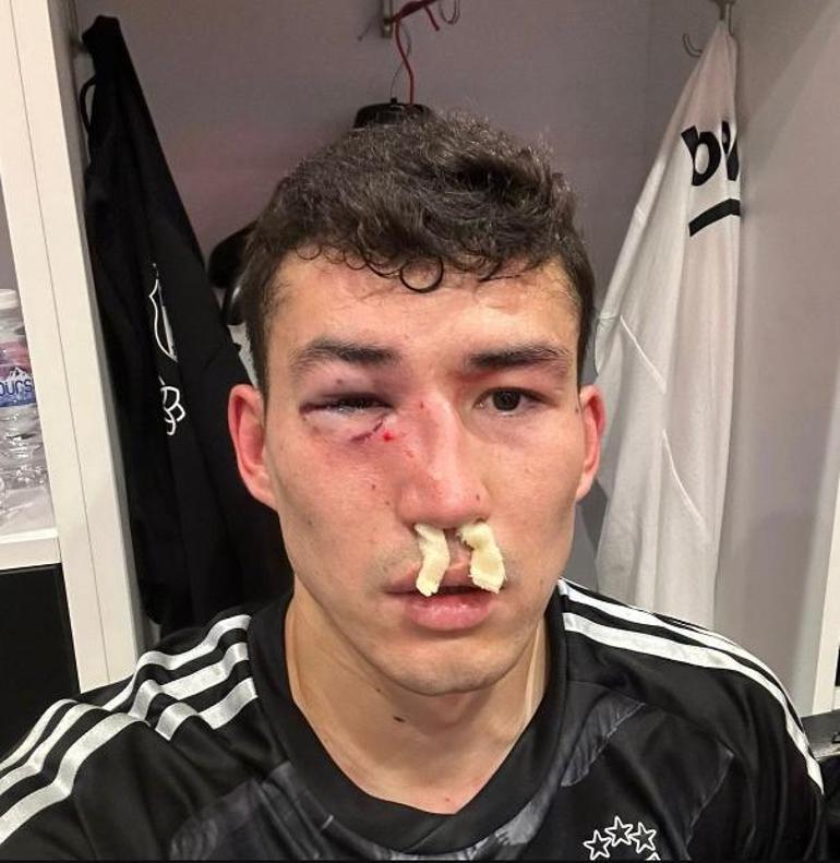 Bahtiyar Zaynutdinov hastaneye kaldırıldı Beşiktaş son halini paylaştı